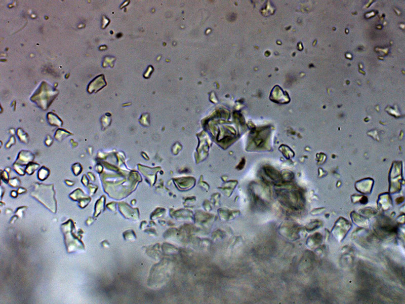 Una corticale granulare da identificare